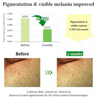 Dr. Althea  Gentle Vitamin C Serum - Ορός Βιταμίνης C για ευαίσθητο δέρμα Ορός προσώπου, 30 ml